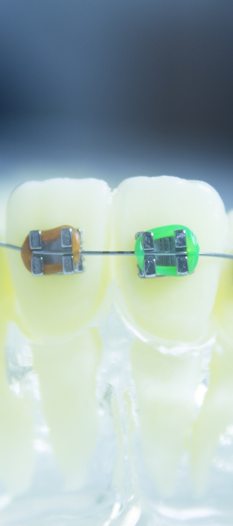 Orthodontic