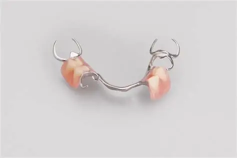 Cast metal denture